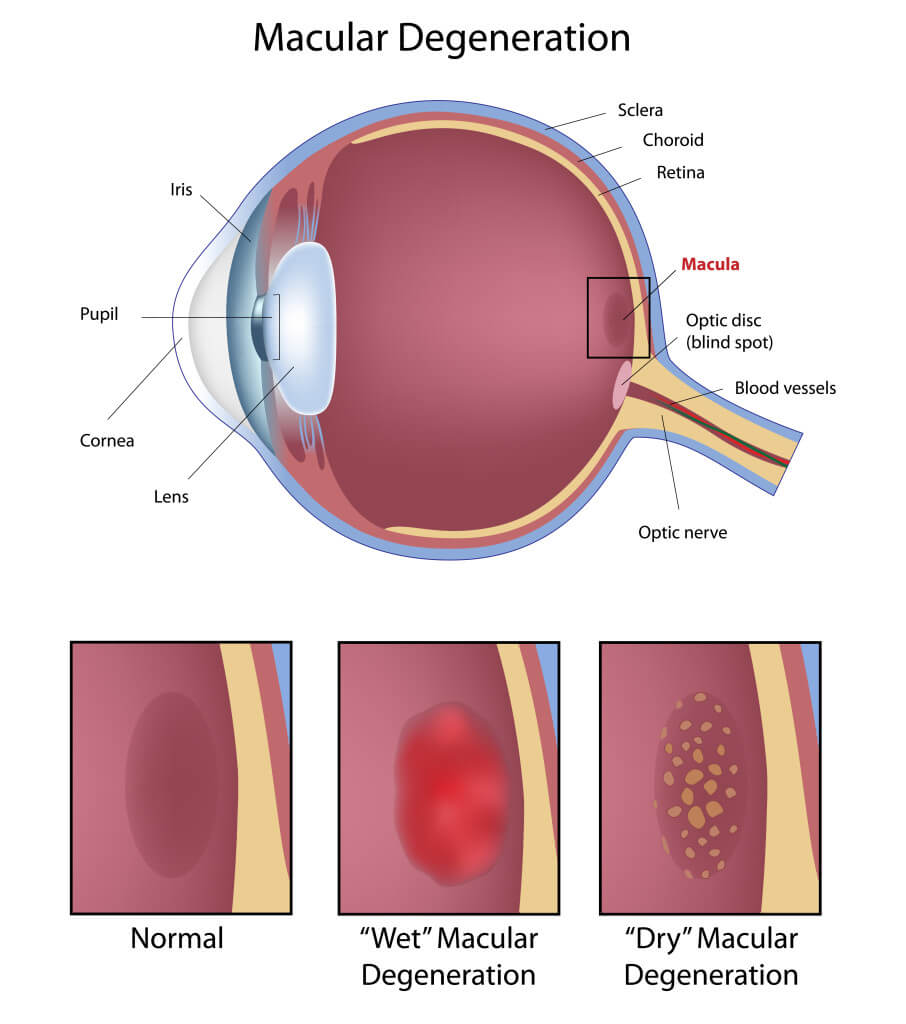 alt_retina_health_center_and_macular_degeneration